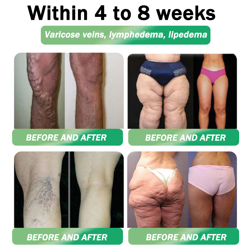 𝑶𝒇𝒇𝒊𝒄𝒊𝒂𝒍 𝑺𝒕𝒐𝒓𝒆|👨‍⚕️👨‍⚕️HH𝐕𝐁® 𝐍𝐀𝐃+ 𝐆𝐋𝐏-𝟏 Pro ALL-IN-ONE Fit&Vital 𝐎𝐫𝐚𝐥 𝐋𝐢𝐪𝐮𝐢𝐝 (𝐉𝐮𝐬𝐭 𝐨𝐧𝐜𝐞 𝐚 𝐝𝐚𝐲, 𝐯𝐢𝐬𝐢𝐛𝐥𝐞 𝐜𝐡𝐚𝐧𝐠𝐞𝐬 𝐢𝐧 𝟕 𝐝𝐚𝐲𝐬） ✅ 𝐅𝐨𝐫 𝐨𝐛𝐞𝐬𝐢𝐭𝐲, 𝐜𝐚𝐫𝐝𝐢𝐨𝐯𝐚𝐬𝐜𝐮𝐥𝐚𝐫 𝐡𝐞𝐚𝐥𝐭𝐡, 𝐝𝐢𝐚𝐛𝐞𝐭𝐞𝐬, 𝐬𝐥𝐞𝐞𝐩 𝐚𝐩𝐧𝐞𝐚, 𝐆𝐮𝐭 𝐇𝐞𝐚𝐥𝐭𝐡, 𝐣𝐨𝐢𝐧𝐭 𝐢𝐬𝐬𝐮𝐞𝐬, 𝐚𝐧𝐝 𝐦𝐨𝐫𝐞