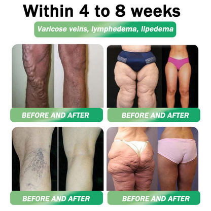 𝑶𝒇𝒇𝒊𝒄𝒊𝒂𝒍 𝑺𝒕𝒐𝒓𝒆|👨‍⚕️👨‍⚕️HH𝐕𝐁® 𝐍𝐀𝐃+ 𝐆𝐋𝐏-𝟏 Pro ALL-IN-ONE Fit&Vital 𝐎𝐫𝐚𝐥 𝐋𝐢𝐪𝐮𝐢𝐝 (𝐉𝐮𝐬𝐭 𝐨𝐧𝐜𝐞 𝐚 𝐝𝐚𝐲, 𝐯𝐢𝐬𝐢𝐛𝐥𝐞 𝐜𝐡𝐚𝐧𝐠𝐞𝐬 𝐢𝐧 𝟕 𝐝𝐚𝐲𝐬） ✅ 𝐅𝐨𝐫 𝐨𝐛𝐞𝐬𝐢𝐭𝐲, 𝐜𝐚𝐫𝐝𝐢𝐨𝐯𝐚𝐬𝐜𝐮𝐥𝐚𝐫 𝐡𝐞𝐚𝐥𝐭𝐡, 𝐝𝐢𝐚𝐛𝐞𝐭𝐞𝐬, 𝐬𝐥𝐞𝐞𝐩 𝐚𝐩𝐧𝐞𝐚, 𝐆𝐮𝐭 𝐇𝐞𝐚𝐥𝐭𝐡, 𝐣𝐨𝐢𝐧𝐭 𝐢𝐬𝐬𝐮𝐞𝐬, 𝐚𝐧𝐝 𝐦𝐨𝐫𝐞