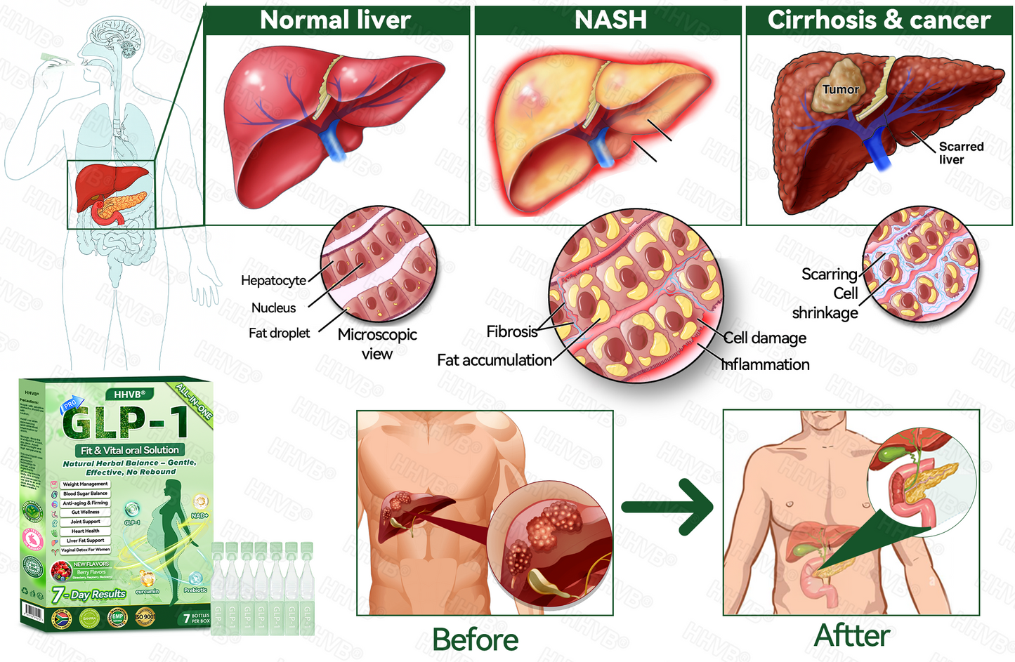 𝑶𝒇𝒇𝒊𝒄𝒊𝒂𝒍 𝑺𝒕𝒐𝒓𝒆|👨‍⚕️👨‍⚕️HH𝐕𝐁® 𝐍𝐀𝐃+ 𝐆𝐋𝐏-𝟏 Pro ALL-IN-ONE Fit&Vital 𝐎𝐫𝐚𝐥 𝐋𝐢𝐪𝐮𝐢𝐝 (𝐉𝐮𝐬𝐭 𝐨𝐧𝐜𝐞 𝐚 𝐝𝐚𝐲, 𝐯𝐢𝐬𝐢𝐛𝐥𝐞 𝐜𝐡𝐚𝐧𝐠𝐞𝐬 𝐢𝐧 𝟕 𝐝𝐚𝐲𝐬） ✅ 𝐅𝐨𝐫 𝐨𝐛𝐞𝐬𝐢𝐭𝐲, 𝐜𝐚𝐫𝐝𝐢𝐨𝐯𝐚𝐬𝐜𝐮𝐥𝐚𝐫 𝐡𝐞𝐚𝐥𝐭𝐡, 𝐝𝐢𝐚𝐛𝐞𝐭𝐞𝐬, 𝐬𝐥𝐞𝐞𝐩 𝐚𝐩𝐧𝐞𝐚, 𝐆𝐮𝐭 𝐇𝐞𝐚𝐥𝐭𝐡, 𝐣𝐨𝐢𝐧𝐭 𝐢𝐬𝐬𝐮𝐞𝐬, 𝐚𝐧𝐝 𝐦𝐨𝐫𝐞