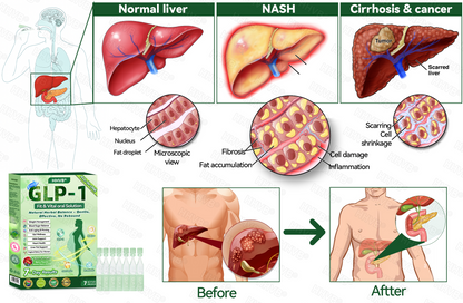 𝑶𝒇𝒇𝒊𝒄𝒊𝒂𝒍 𝑺𝒕𝒐𝒓𝒆|👨‍⚕️👨‍⚕️HH𝐕𝐁® 𝐍𝐀𝐃+ 𝐆𝐋𝐏-𝟏 Pro ALL-IN-ONE Fit&Vital 𝐎𝐫𝐚𝐥 𝐋𝐢𝐪𝐮𝐢𝐝 (𝐉𝐮𝐬𝐭 𝐨𝐧𝐜𝐞 𝐚 𝐝𝐚𝐲, 𝐯𝐢𝐬𝐢𝐛𝐥𝐞 𝐜𝐡𝐚𝐧𝐠𝐞𝐬 𝐢𝐧 𝟕 𝐝𝐚𝐲𝐬） ✅ 𝐅𝐨𝐫 𝐨𝐛𝐞𝐬𝐢𝐭𝐲, 𝐜𝐚𝐫𝐝𝐢𝐨𝐯𝐚𝐬𝐜𝐮𝐥𝐚𝐫 𝐡𝐞𝐚𝐥𝐭𝐡, 𝐝𝐢𝐚𝐛𝐞𝐭𝐞𝐬, 𝐬𝐥𝐞𝐞𝐩 𝐚𝐩𝐧𝐞𝐚, 𝐆𝐮𝐭 𝐇𝐞𝐚𝐥𝐭𝐡, 𝐣𝐨𝐢𝐧𝐭 𝐢𝐬𝐬𝐮𝐞𝐬, 𝐚𝐧𝐝 𝐦𝐨𝐫𝐞